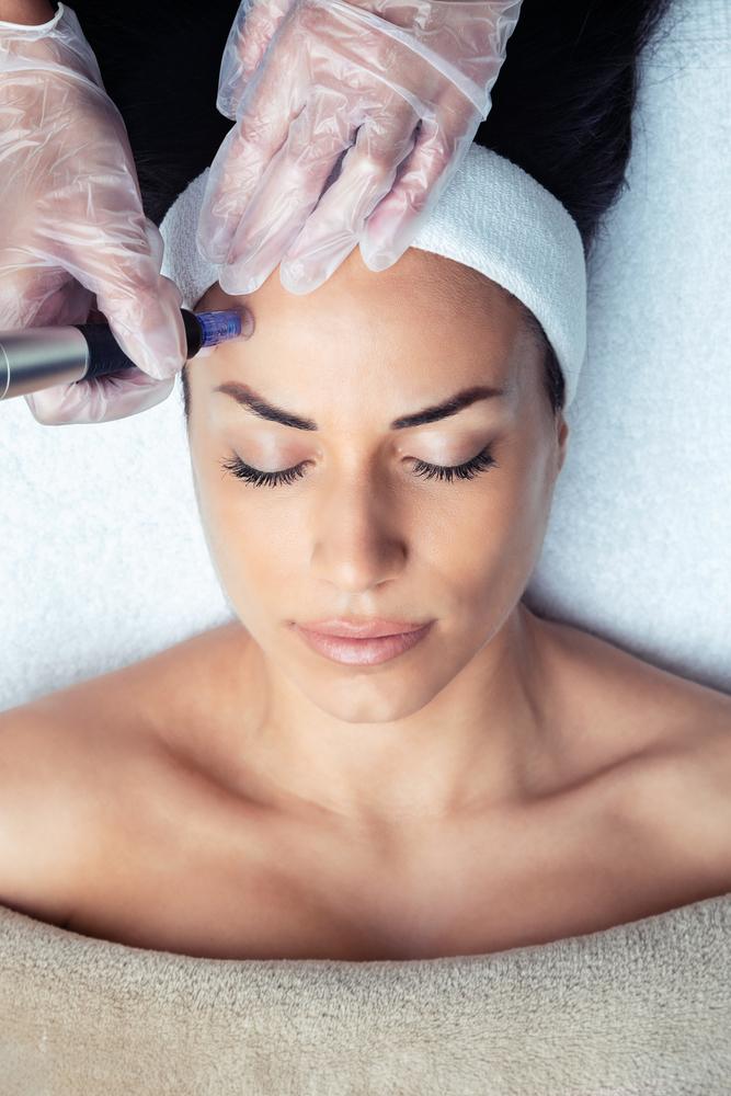 Micro-Needling